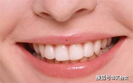 爆料牙齿美白是真的吗视频,视频爆料揭示真实效果  第2张